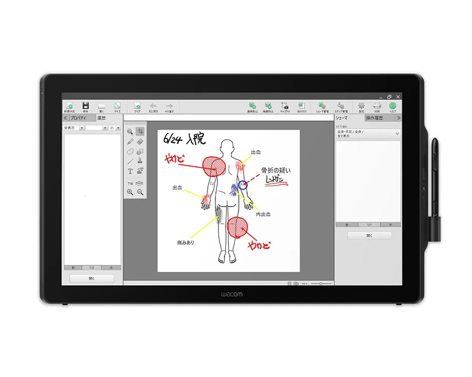 Wacom 24 inch Full HD Interactive Pen & Touch Display T2
